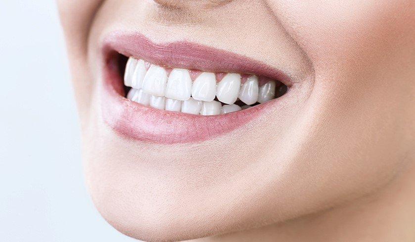 prix hollywood smile tunisie