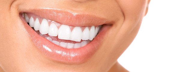 resultat blanchiment dentaire tunisie