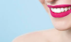 Les facettes changent la couleur des dents