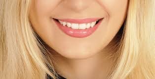 Les facettes changent la forme de la dent