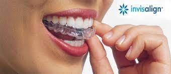 Invisalign