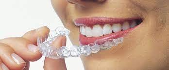 Orthodontie Invisalign