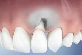 causes dent qui bouge