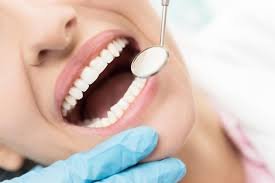 blanchiment interne dent dévitalisée