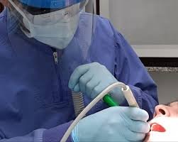 nettoyage professionnel dents