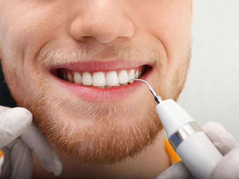 nettoyage contre plaque dentaire