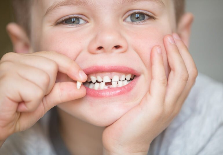 perte dents de lait