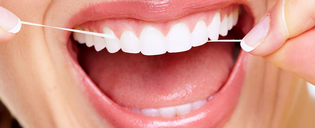 remèdes pour prévenir la formation de plaque dentaire