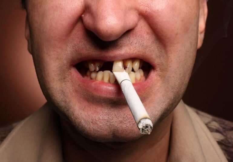dégâts tabac sur santé buccodentaire