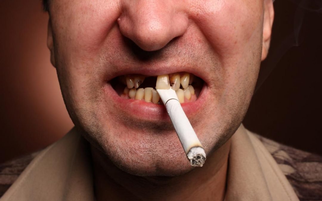 dégâts tabac sur santé buccodentaire