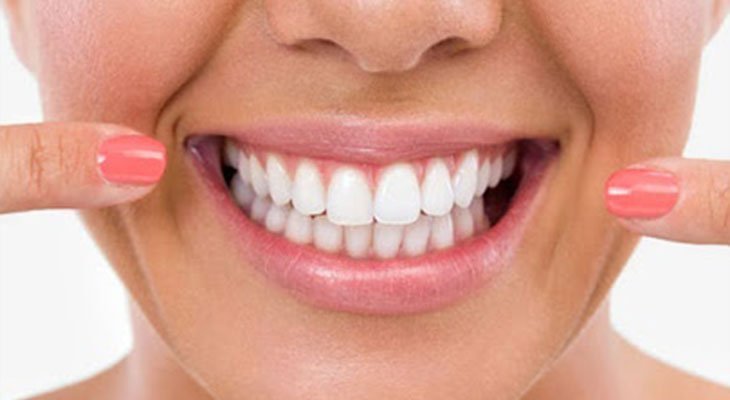 refaire blanchiment dentaire