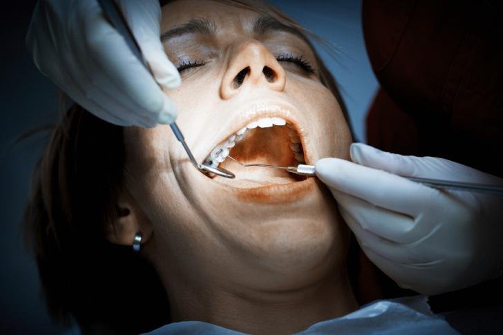 candidat remplissage dentaire